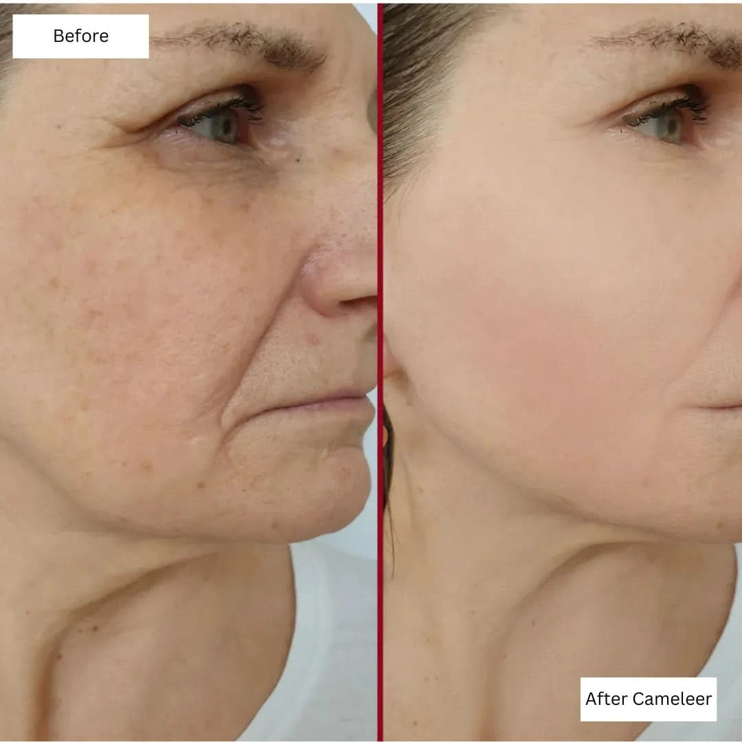 Repair, Revive & Rejuvenate Your Skin With Cameleer Face Mask - Dityana™ Skincare