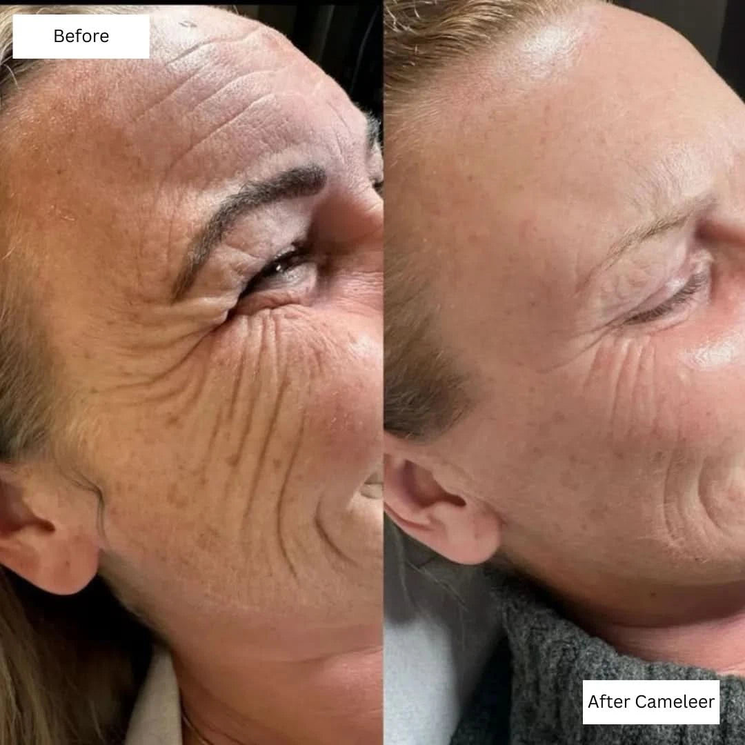 Repair, Revive & Rejuvenate Your Skin With Cameleer Face Mask - Dityana™ Skincare