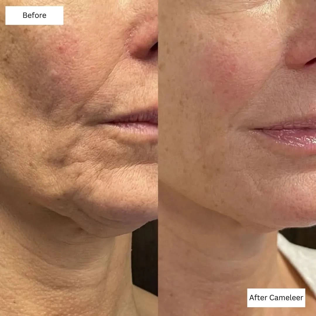 Repair, Revive & Rejuvenate Your Skin With Cameleer Face Mask - Dityana™ Skincare