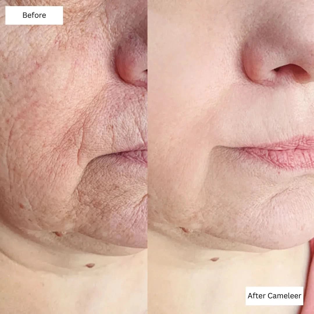 Repair, Revive & Rejuvenate Your Skin With Cameleer Face Mask - Dityana™ Skincare