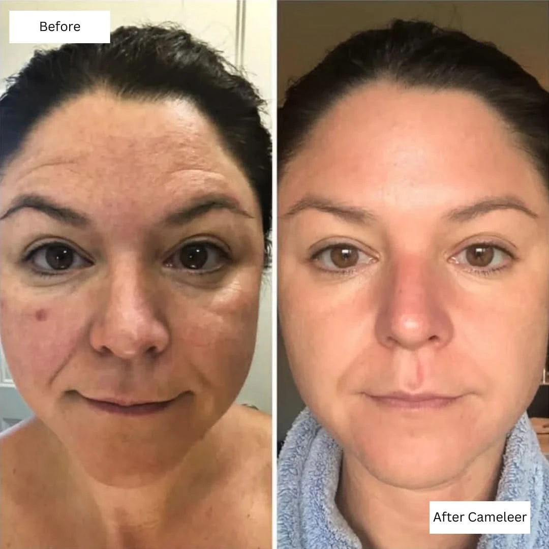 Repair, Revive & Rejuvenate Your Skin With Cameleer Face Mask - Dityana™ Skincare