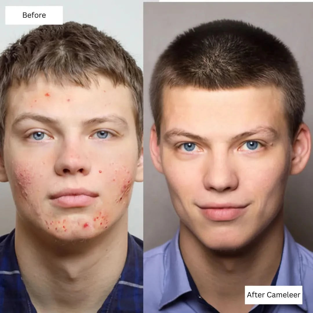 Repair, Revive & Rejuvenate Your Skin With Cameleer Face Mask - Dityana™ Skincare