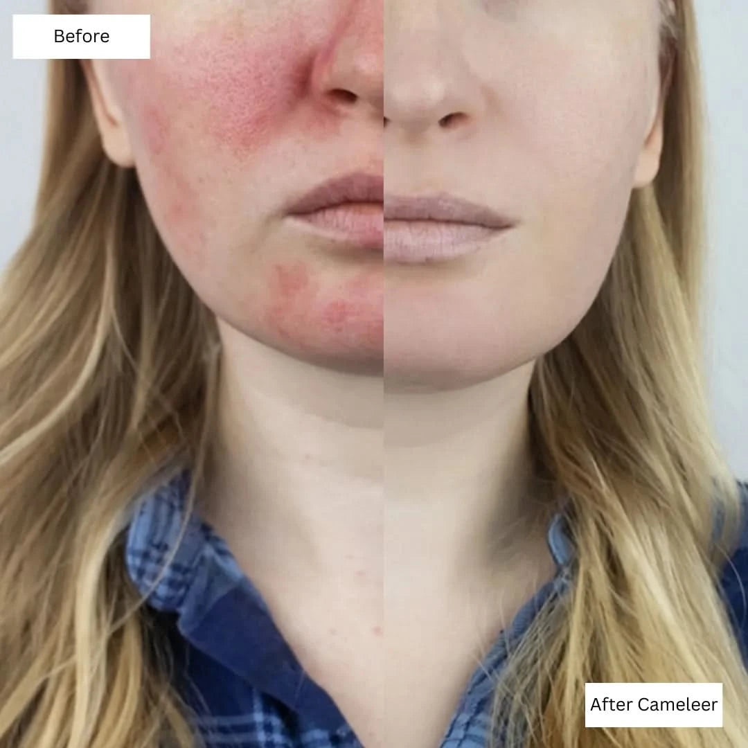 Repair, Revive & Rejuvenate Your Skin With Cameleer Face Mask - Dityana™ Skincare